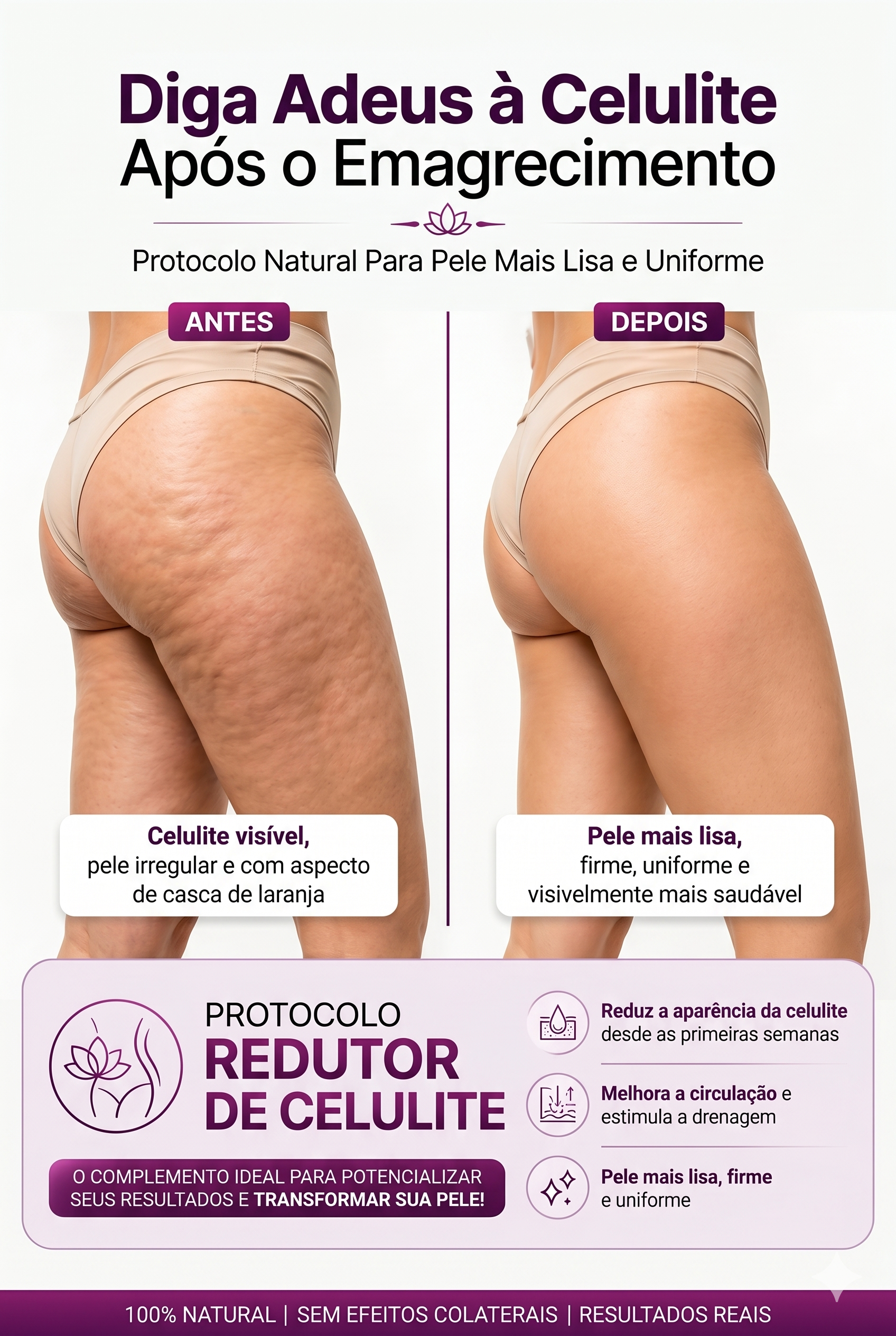 Antes e Depois da Celulite
